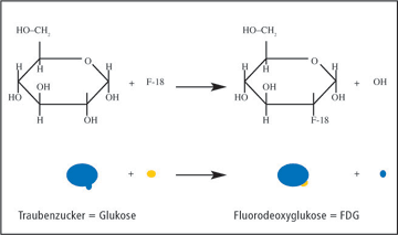 Formel: Glukose > FDG